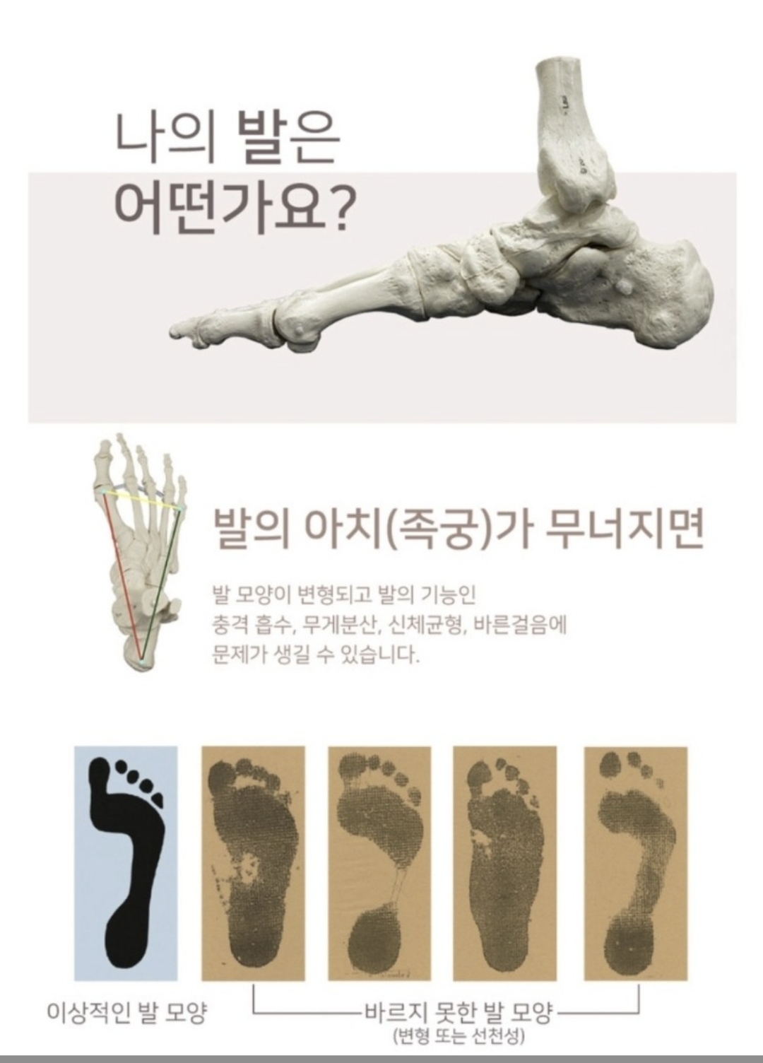 3067302113_nWeJ9dob_ada19765db7ece72de3fc56770dbd189eb8cb2ff.jpg 이미지크게보기